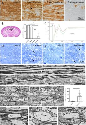 Cuprizone Intoxication Results in Myelin Vacuole Formation